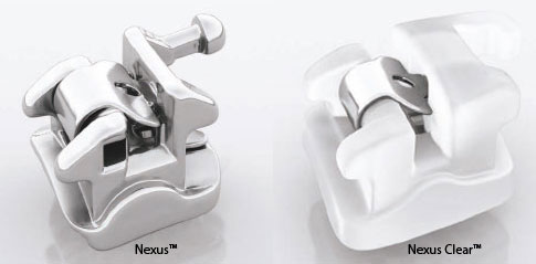 Nexus™ et Nexus Clear™ de Ormco-Dr Chamberland orthodontiste à Québec