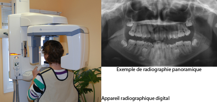 Prise de radio panoramique-Dr Chamberland orthodontiste à Québec